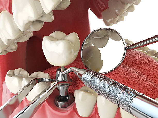 Best Orthodontic Emergency Dentist in Rlborough, MA